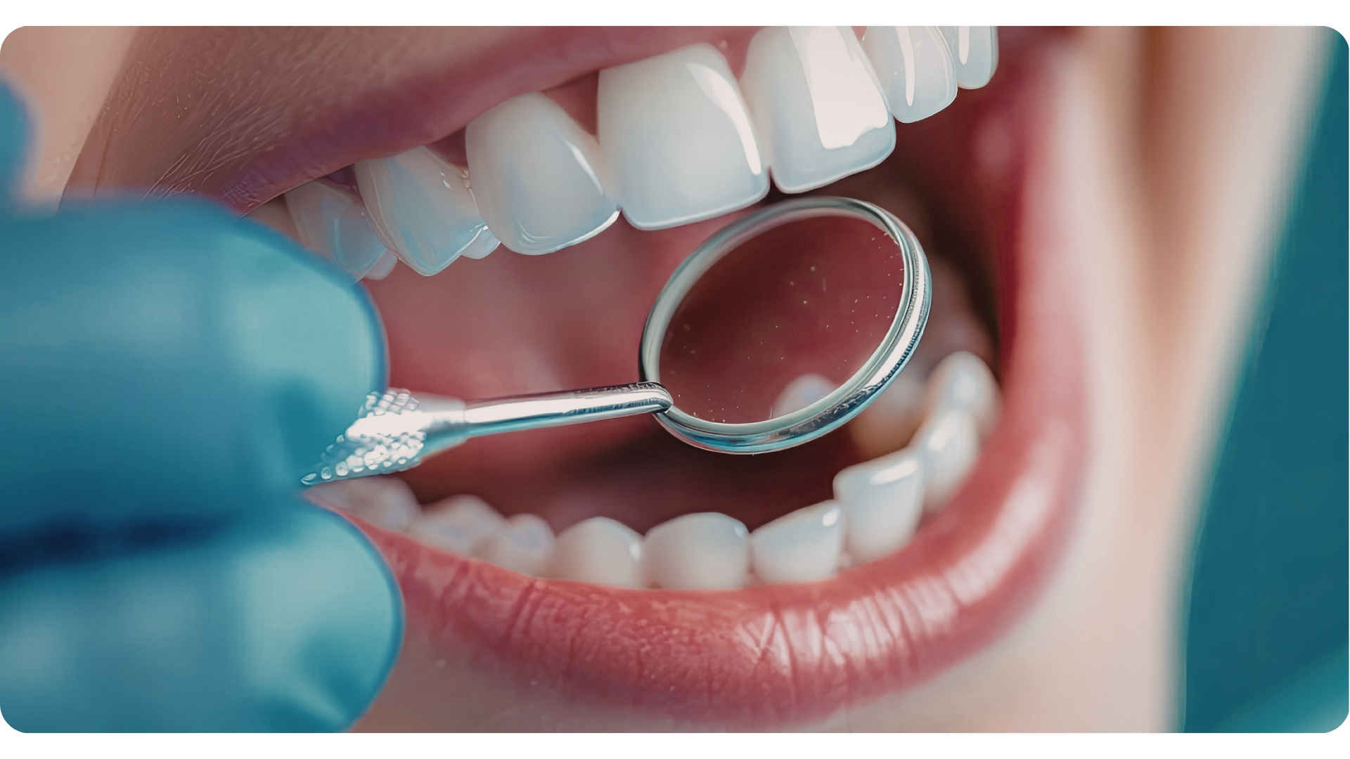 General Dental Checkup , Elevate Dental Wellness , Midhilapuri VUDA Colony , PM Palem , Visakhapatnam